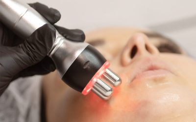 Laser Treatments: Rejuvenation Beyond Surface