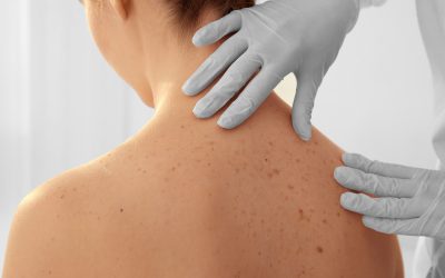 A Gentle Way to Restore Firm, Youthful Skin