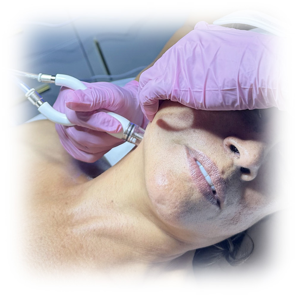 diamond-glow-treatments-3