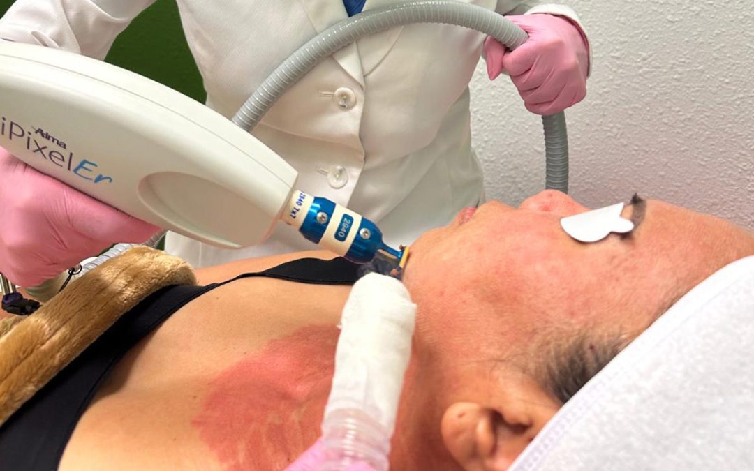 Discover the power of Laser Facial Rejuvenation