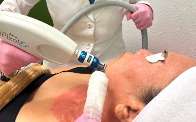 Descubre el poder del rejuvenecimiento facial con láser