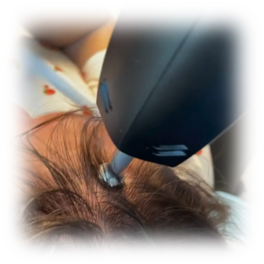 hair-restoration-treatments-04
