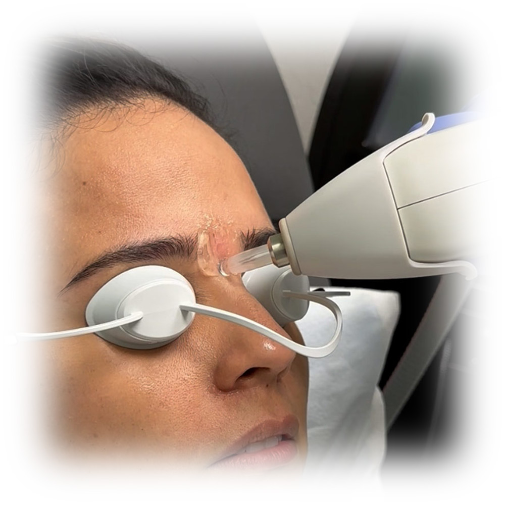 laser-treatments-05